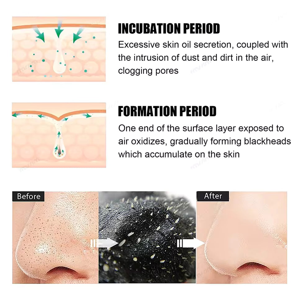 ClearSkin Nose Strips