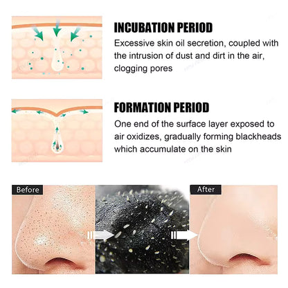 ClearSkin Nose Strips